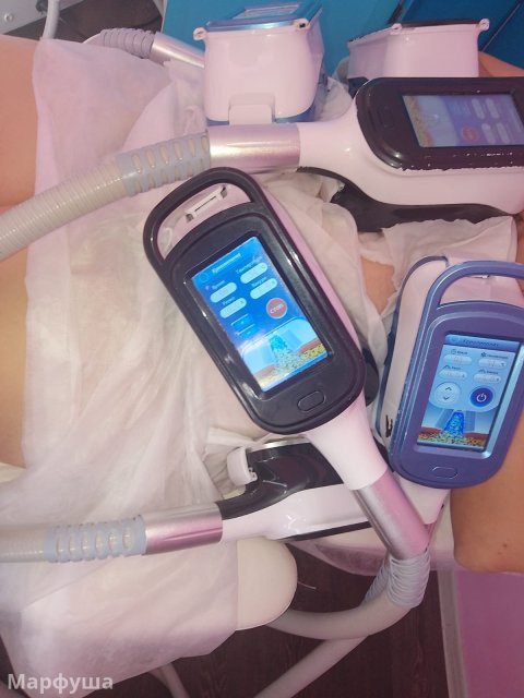 Криолиполиз, кавитация, РФ лифтинг лица и тела